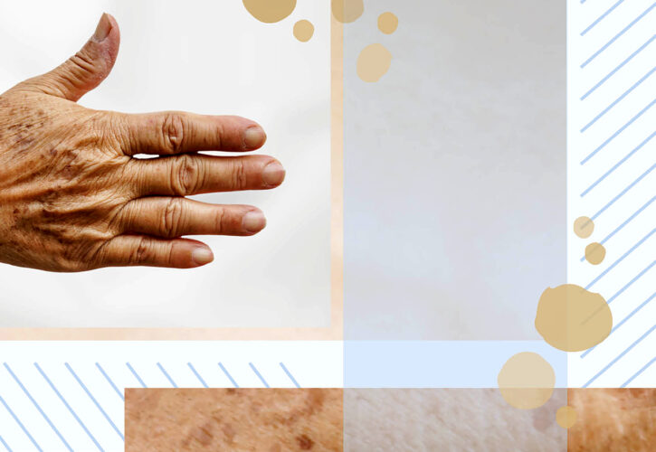 Tratamiento Blanqueador / Rejuvenecimiento de Manos