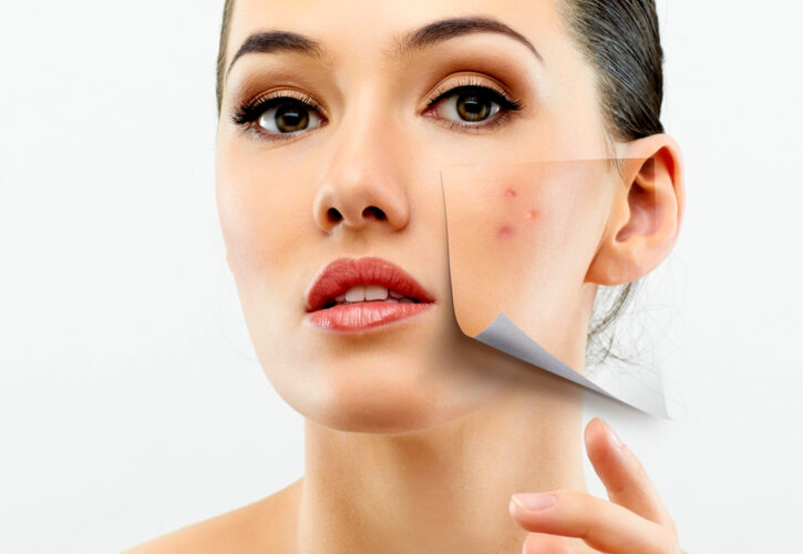 Tratamiento de Cicatrices