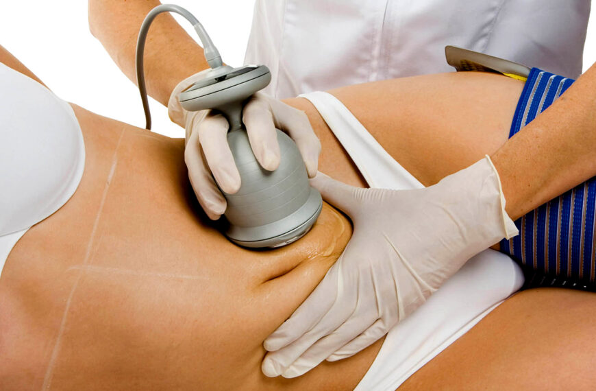 Cavix (Ultracavitación)